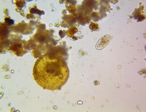 Testate amoebae
