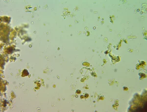Testate amoeba